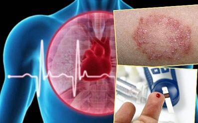 Contre-indications pour le lipolifting
