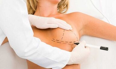 Comment augmenter le cerveau des implants