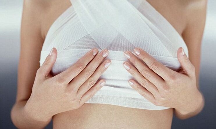 Seins bandés après une opération d’augmentation mammaire.